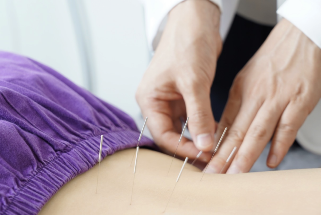 Acupuncture for automimmune conditions